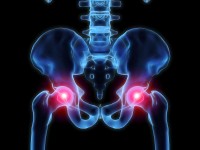 illustration of inflammed hip joints